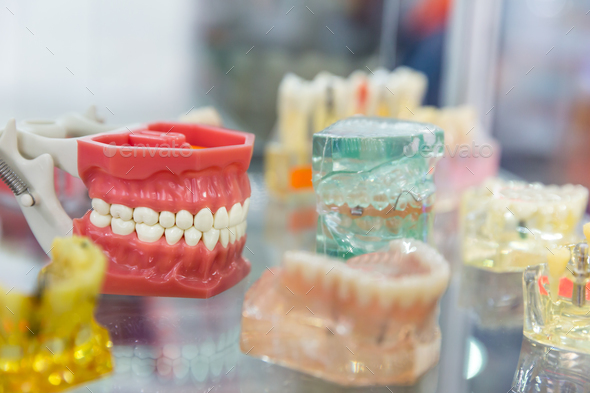 Denture treatment, dental implants, orthodontic Stock Photo by NomadSoul1