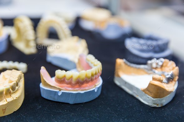 Denture treatment, dental implants closeup Stock Photo by NomadSoul1