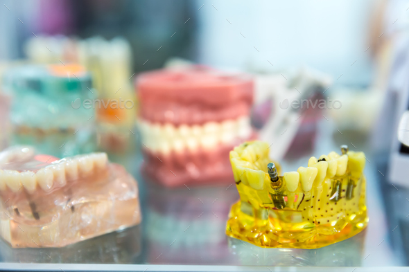 Medicine equipment, prosthetic dentistry, dentures Stock Photo by NomadSoul1