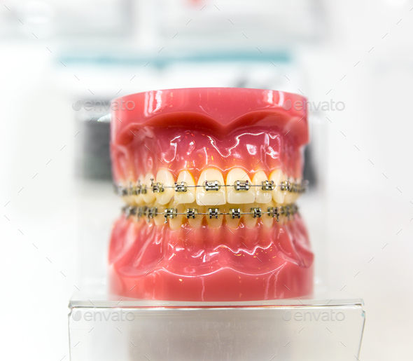 Dental equipment, orthodontic, denture closeup Stock Photo by NomadSoul1