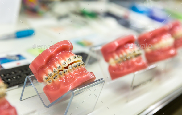 Dental, medicine equipment, orthodontic Stock Photo by NomadSoul1 | PhotoDune
