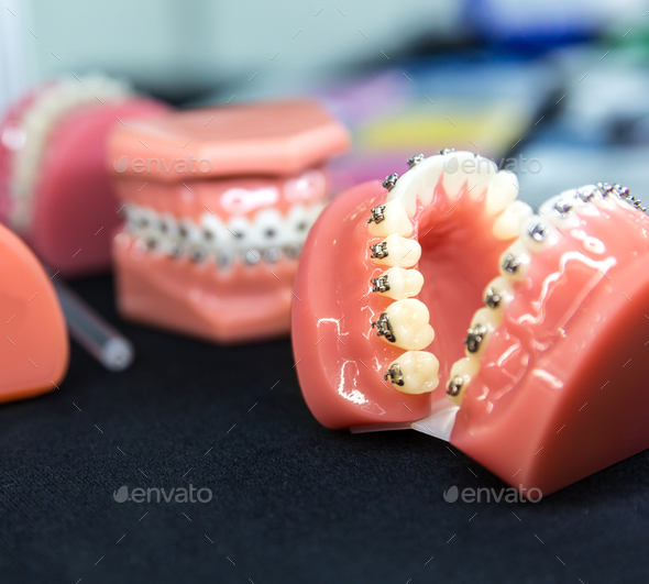 Dental or orthodontic tools, denture closeup Stock Photo by NomadSoul1