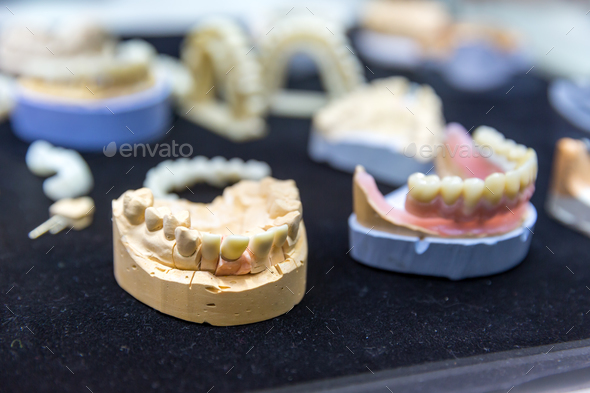 Denture, prosthetic dentistry, dental implants Stock Photo by NomadSoul1