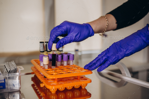 Hand Of A Lab Technician Holding Blood Tube Test And Background A Rack