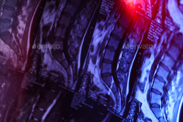 MRI Or Magnetic Resonance Imaging Of The Human Spine Close Up Stock