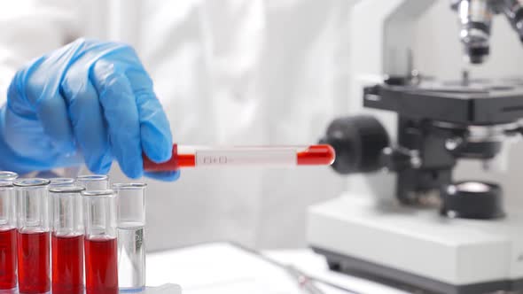 The Laboratory Assistant Performs a Microbiological Analysis of Blood Smears alt