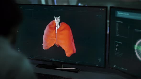 Doctor supervising the x-ray analysis of a sick person at the medical laboratory alt