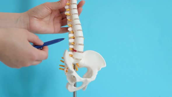 Intervertebral Hernia of the Cervical Spine Rupture of the Fibrous Ring alt