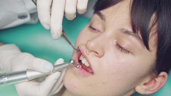 Stomatologist in white gloves cleaning the teeth of a woman in dental cabinet. alt
