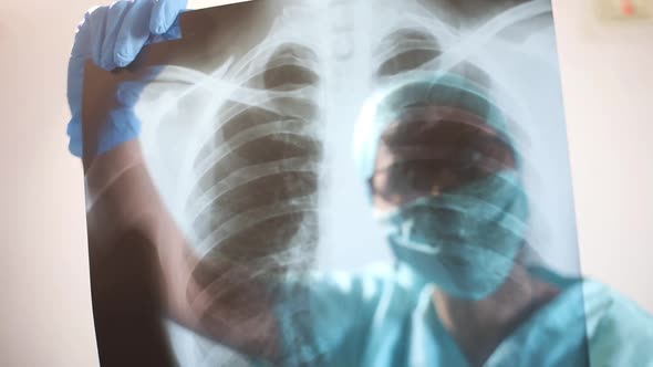 Doctor holding and analyzing an x-ray of some lungs