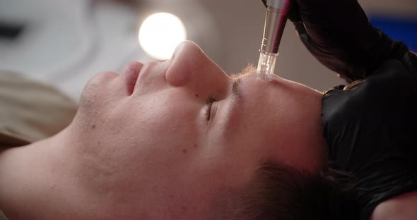 Man Receives Face Needle Mesotherapy Procedure at the Cosmetology Salon  60p