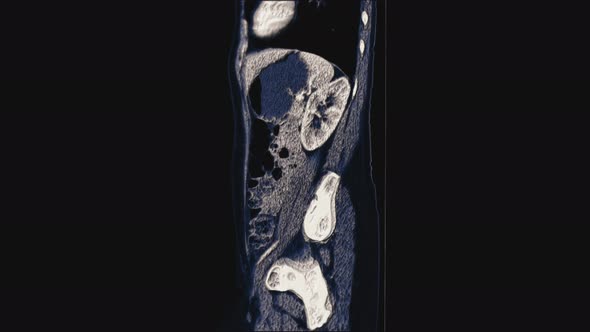 Voluminous Color MRI of the Female Pelvic Organs Abdominal Cavity Gastrointestinal Tract and Bladder alt