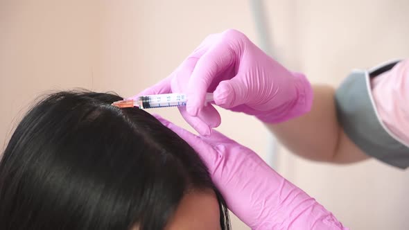Patient getting head injections. Concept of hair loss. Cosmetological clinic alt