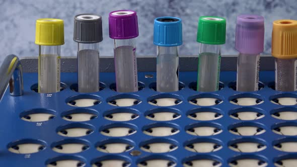  Empty test tubes with colorful caps in a tray on a blue background