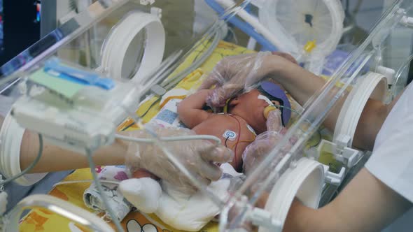Ultrasonic Procedure Held on a Newborn Baby By a Team of Doctors alt