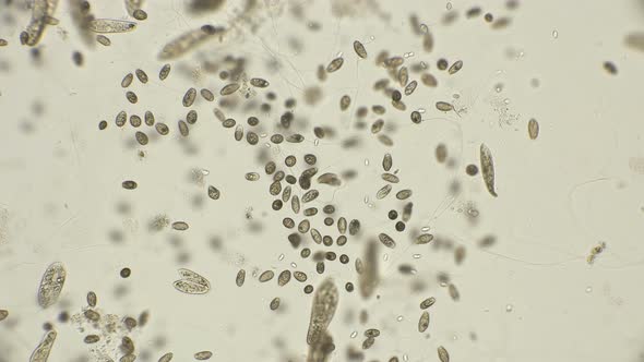 a Large Colony of Ciliates Coleps, Which Are Largely Located in Dirty ...