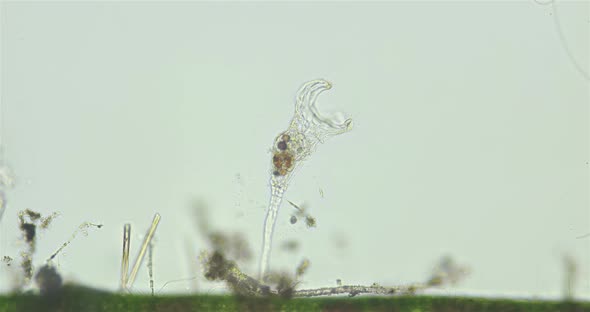 Rotifera of family Collothecidae under a microscope, possibly Collotheca ornata alt