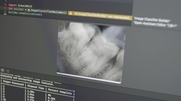 Jaw teeth Xray Analysis with Neural Network