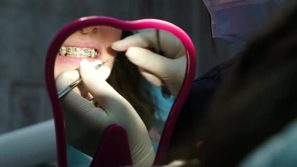 Visit and Consultation of the Dentist, Installation of Braces alt
