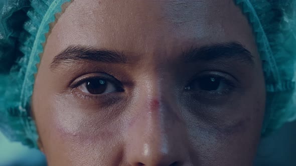 Nurse shows the wounds rubbed with protective mask after shift in hospital alt