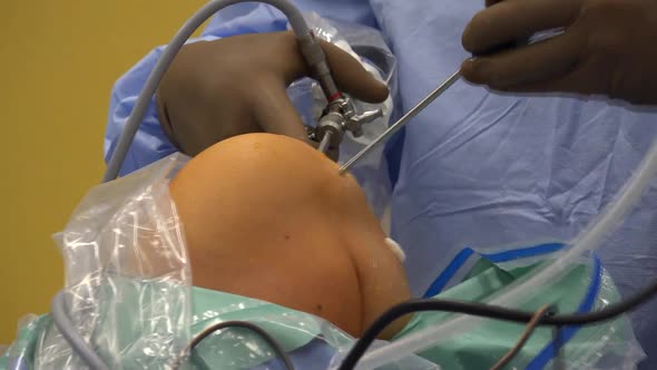 Arthroscopy and Knee Ligament Surgery 9