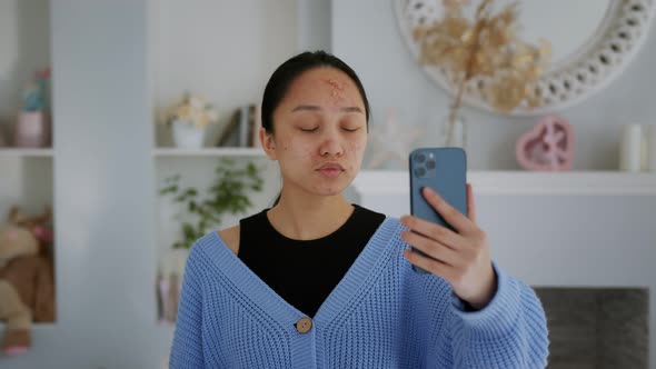 Asian Young Girl with Acne Looks at the Phone and Touches the Screen
