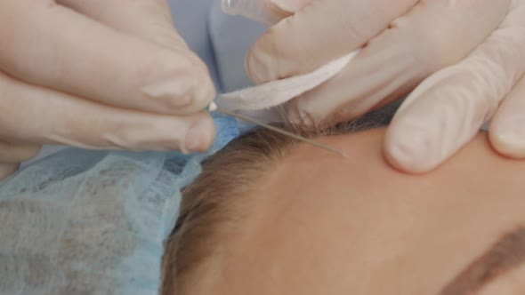 The Doctor Gives a Botox Injection Into the Patient's Forehead