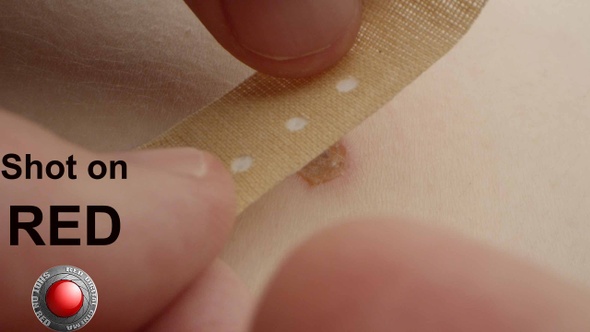 Bandage Plaster On A Skin Wound Injury  alt