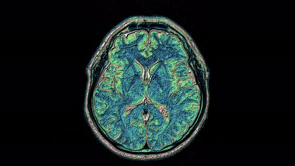 Bulk Multicolored MRI Scans of the Brain and Head To Detect Tumors. Diagnostic Medical Tool alt