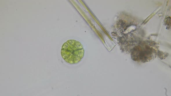 Paramecium Bursaria Protozoan Under The Microscope, Stock Footage ...