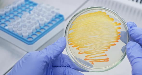 Petri dish with bacteria in the hands of a scientist.