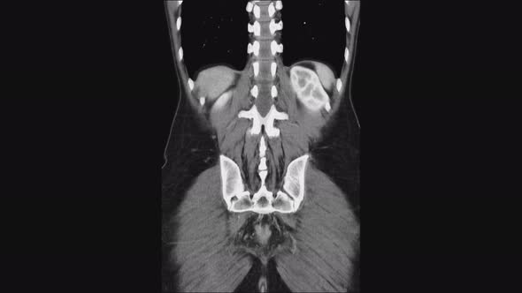 MRI of the Female Pelvic Organs, Abdominal Cavity, Gastrointestinal Tract and Bladder alt