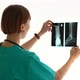 Woman Doctor Looking at Xray Scan of a Leg Spbas