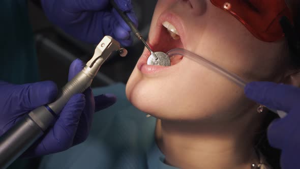 Dentist Is Taking Care About Patient's Tooth Using Electric Dental Brush, Opening Patient's Mouth alt