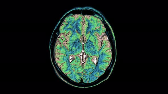 Bulk Multicolored MRI Scans of the Brain and Head To Detect Tumors alt