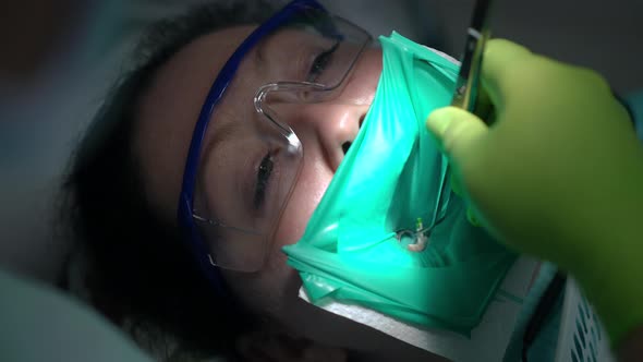 Closeup Dentist Pulling Out Root Canal Cleaning File with Tweezers in Slow Motion alt