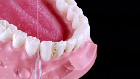 Irrigator Cleaning Teeth with Stucked Food alt