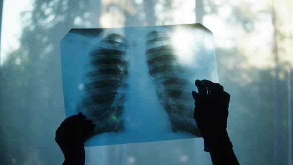 Holding Xray Image of Human Chest on Window Background Doctor Checking Fluorography of Patient on alt