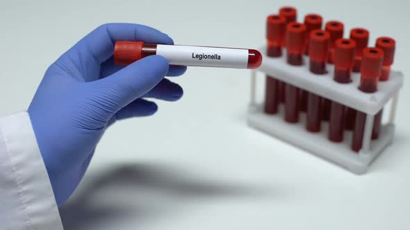 Legionella, Doctor Showing Blood Sample in Tube, Lab Research, Health Checkup alt