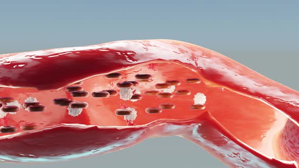 Red blood cells flow inside an artery, viewed from the transverse artery. alt
