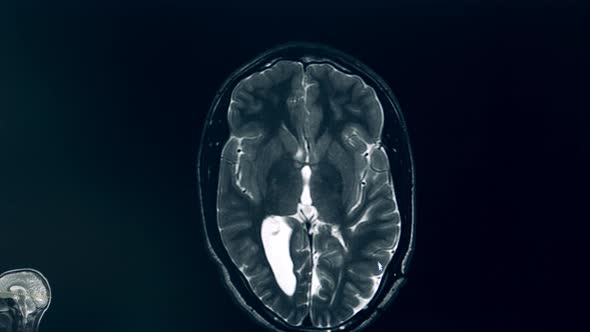 Computer Image of a Brain During MRI Procedure alt