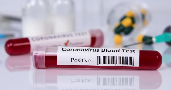 Blood Test Tube With Coronavirus Disease Closeup