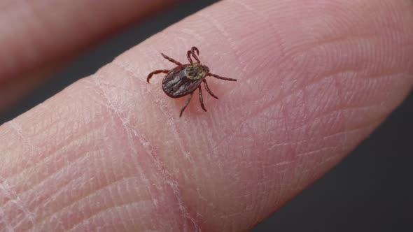 Blood-sucking Mite Tick Creepes on the Human Finger To Bite alt