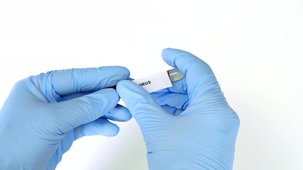 Concept Blood Test. Hands in Blue Gloves, Hold the Tube with Real Blood. alt
