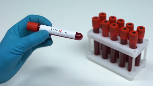 Negative EV 71 Test, Doctor Showing Blood Sample, Lab Research, Health Check-Up alt