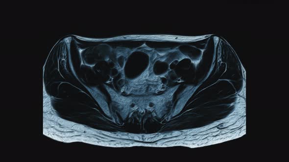 Voluminous Color MRI of the Female Pelvic Organs, Abdominal Cavity, Gastrointestinal Tract and alt