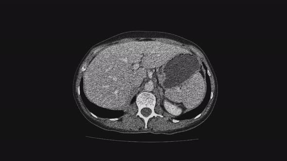 Voluminous MRI of the Female Pelvic Organs, Abdominal Cavity, Gastrointestinal Tract and Bladder alt
