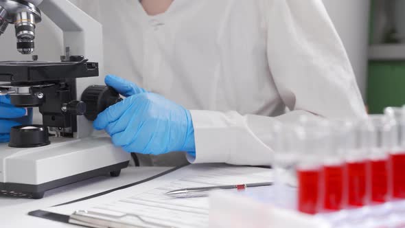 The Laboratory Assistant Performs a Microbiological Analysis of Blood Smears. Concept - Hematologic alt