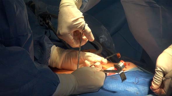 Surgical Suture Or Stitches alt