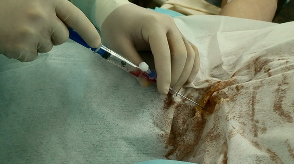 Central Vein Puncture And Catheterization